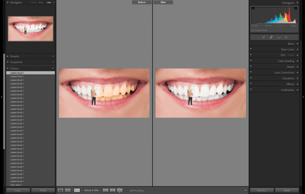Teeth Whitening Preset - Before and After